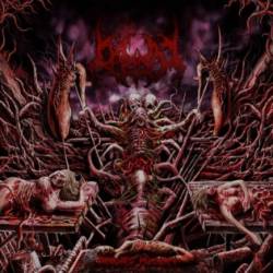 Bigot : Interrupted Pregnancy